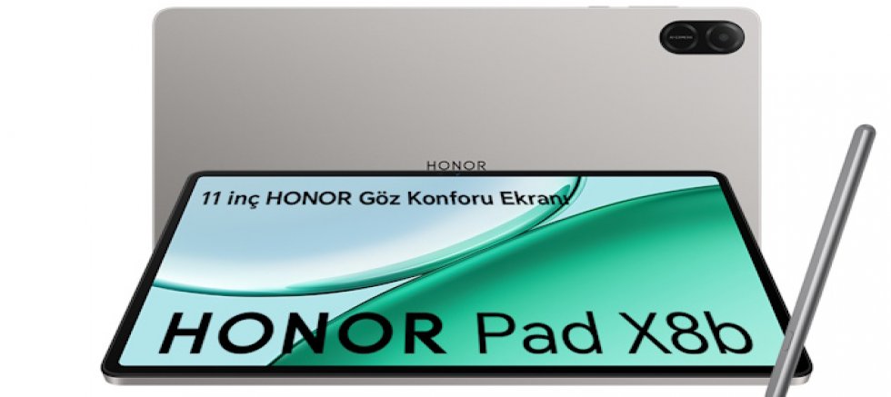 GÖZ KONFORU NEDİR DEMEYİN O DA HONORLA OLDU