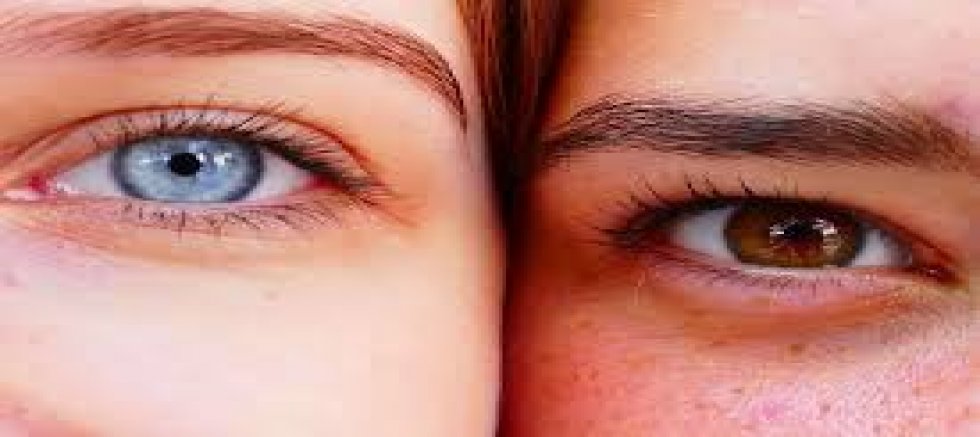 GÖZKAPAKLARINIZ GENÇLİĞİNİZİ KALICILAŞTIRABİLİRMİŞ