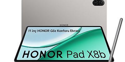 GÖZ KONFORU NEDİR DEMEYİN O DA HONORLA OLDU