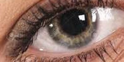 LAZERLE GÖZ TEDAVİSİNDE PATLAMA