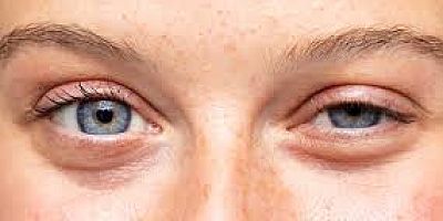 O ESTETİKTE YENİ DÖNEM