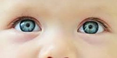 O TEDAVİ İHMALE ASLA GELMEMELİ