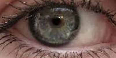 O TEDAVİDE BİR LAZER ÖNERİSİ DAHA