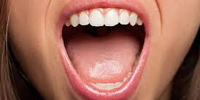 O YARALAR ÖNEMLİ VE ÖNEMSENMELİ